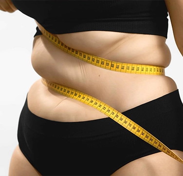 Obesity